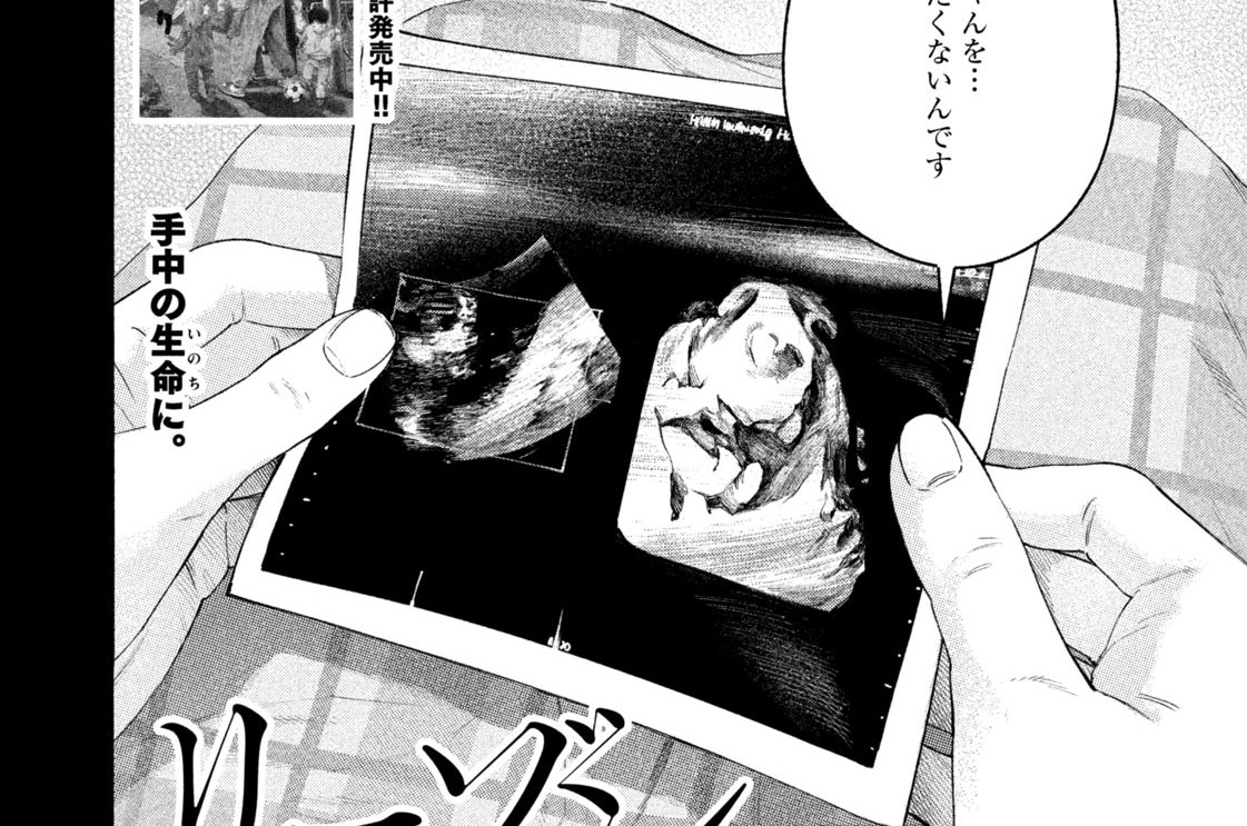 ＃１３９　出生前診断①