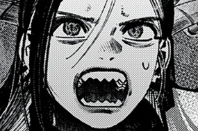 第３４話　Flexor retinaculum：屈筋支帯①