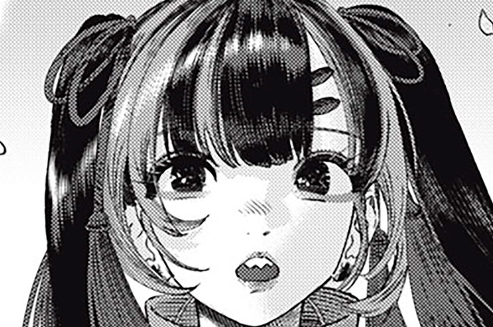 第４７話　Common bile duct stone：総胆管結石①