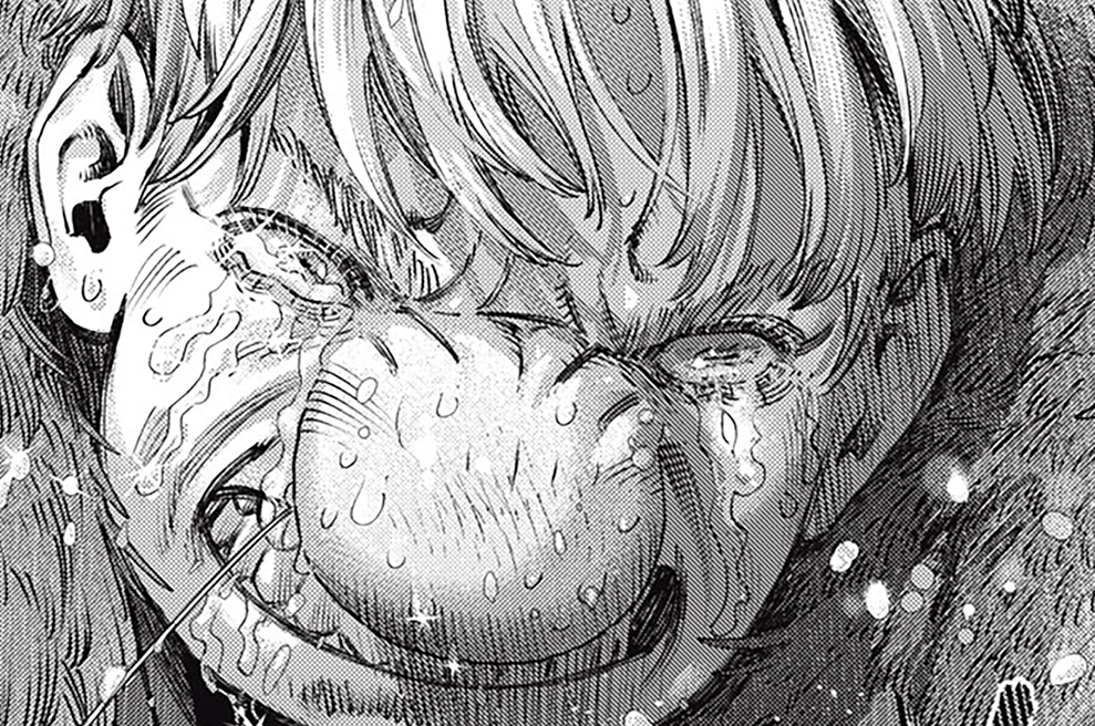 第４８話　Lithotripsy：結石破砕術②