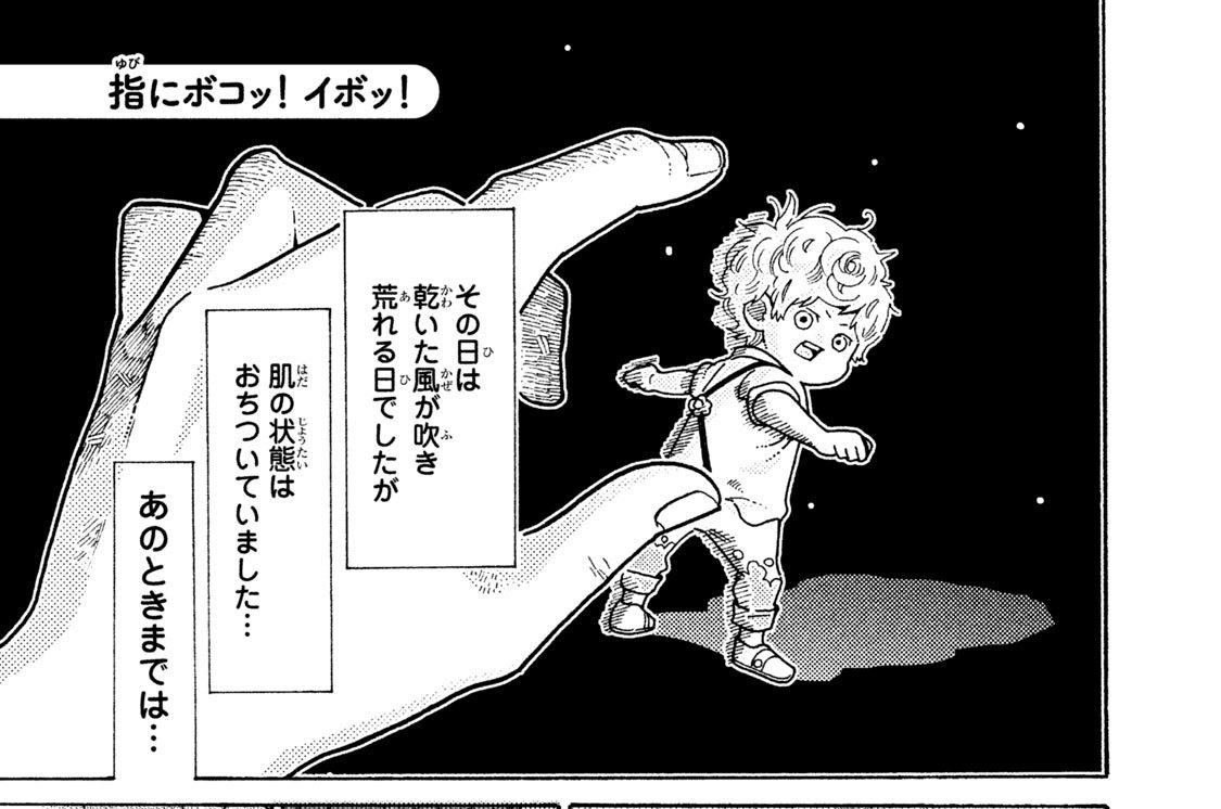 指にボコッ！ イボッ！
